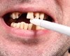 50 درصد مبتلایان سرطان دهان دخانیات مصرف می کنند