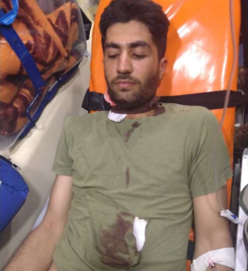 حمله شکارچیان به محیط بان با چاقو