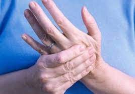 زنان ۲ برابر مردان به بیماری آرتریت روماتوئید مبتلا می‌شوند