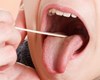 زخم دهان را جدی بگیرید/ پیشگیری، علائم و درمان سرطان دهان و زبان