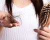 نسخه‌ای برای درمان ریزش مو در بهبودیافتگان کرونا