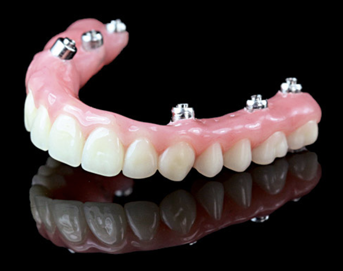 دندان مصنوعی ثابت چیست؟؟