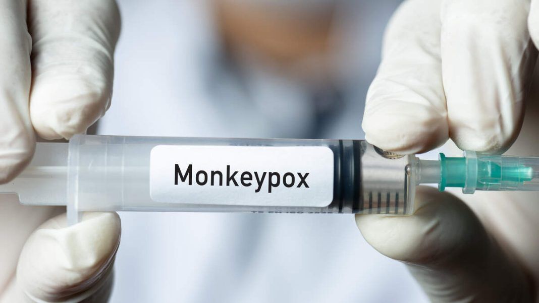 اعلام وضعیت اضطراری برای شیوع آبله میمون